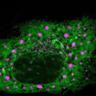 Organelle network in green