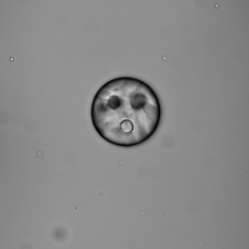 Bright-field image of a droplet with inclusions that look like a face