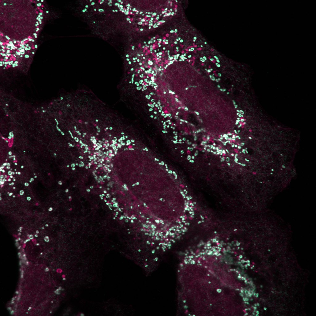 Several cells with small organelles in cyan and magenta