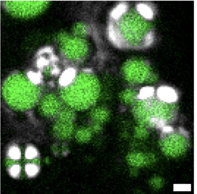 Lipid droplets in green inside a cell